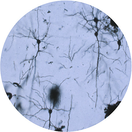Neuron - Giant Microbe