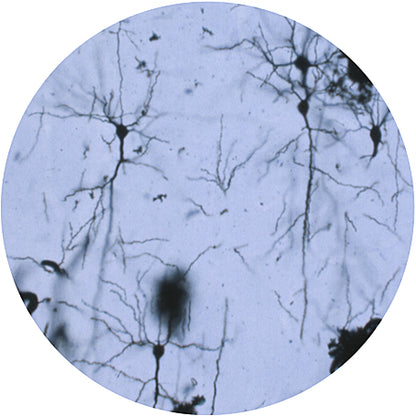 Neuron - Giant Microbe